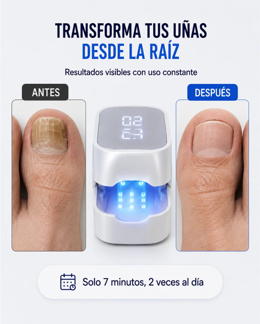 NailLaser Pro™